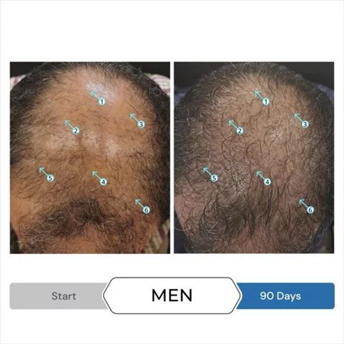 Spectrl.UHF 60ml - Serum chống rụng tóc, kích mọc tóc dành cho Nam. Spectrl.UHF 60ml - Serum chống rụng tóc, kích mọc tóc dành cho Nam.