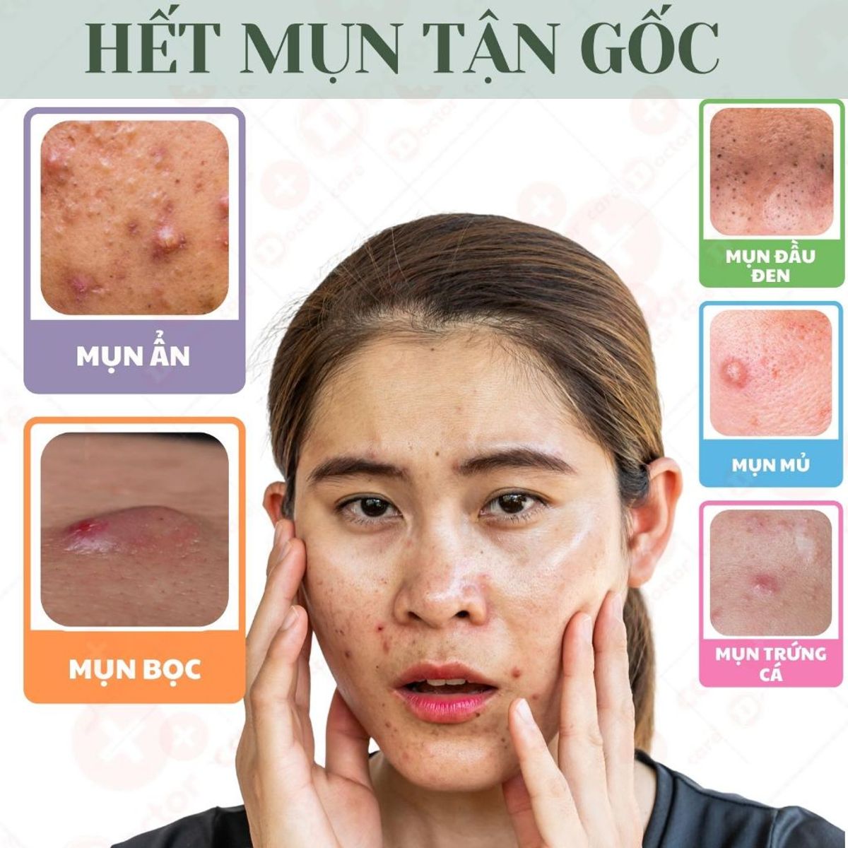 Làn da trắng sáng