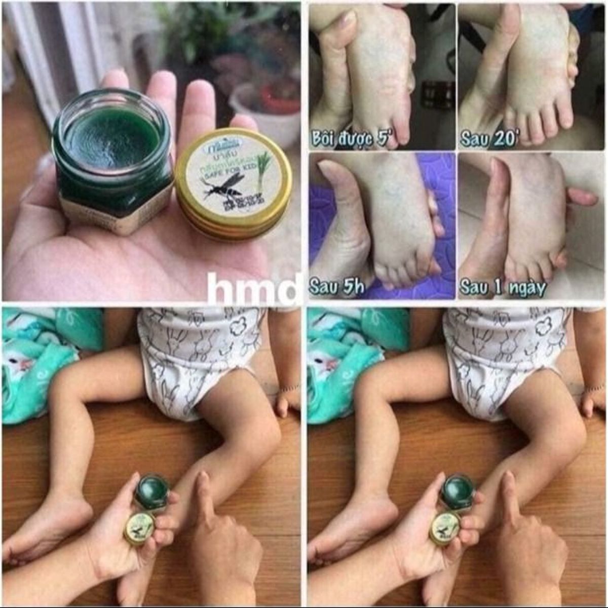 KEM BÔI MUỖI TRẺ EM HÀNG CHUẨN THÁI LỌ 13G CTB447 - BECHIP KEM BÔI MUỖI TRẺ EM HÀNG CHUẨN THÁI LỌ 13G CTB447 - BECHIP