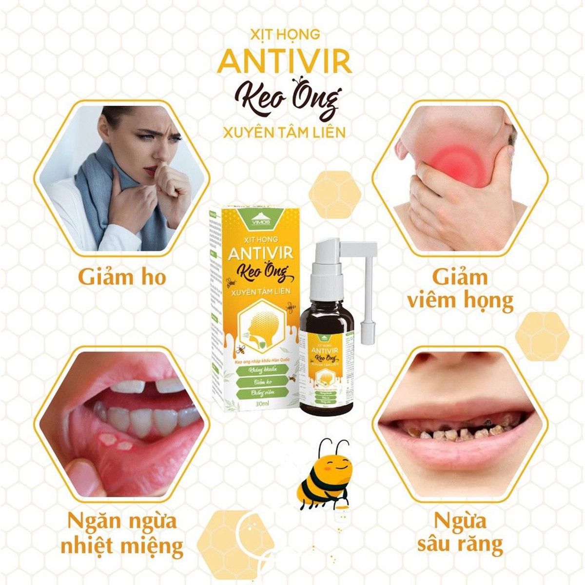 Chai xịt họng Antivir Keo ong xuyên tâm liên Vimos giúp hạn chế viêm lợi, nhiệt miệng, giảm ho,đau rát họng chai 30ml Chai xịt họng Antivir Keo ong xuyên tâm liên Vimos giúp hạn chế viêm lợi, nhiệt miệng, giảm ho,đau rát họng chai 30ml