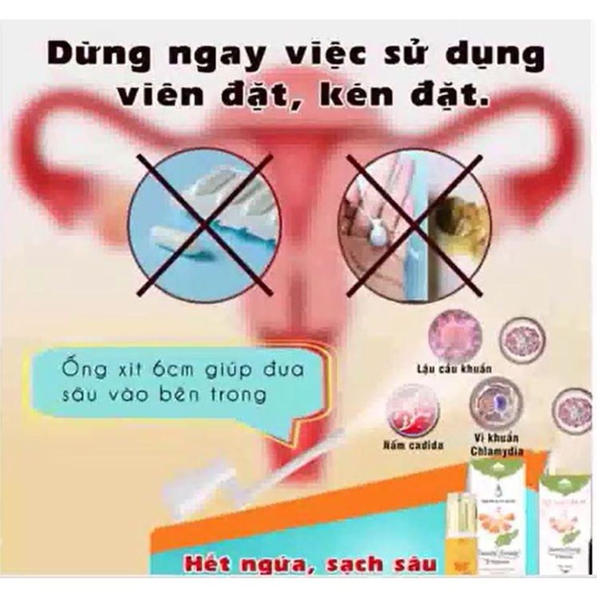 Combo 2 chai Xịt phụ khoa cao cấp Vimos Luxury Beauty Princess giúp khử nấm ngứa, khí hư, mùi hôi 50ml Combo 2 chai Xịt phụ khoa cao cấp Vimos Luxury Beauty Princess giúp khử nấm ngứa, khí hư, mùi hôi 50ml