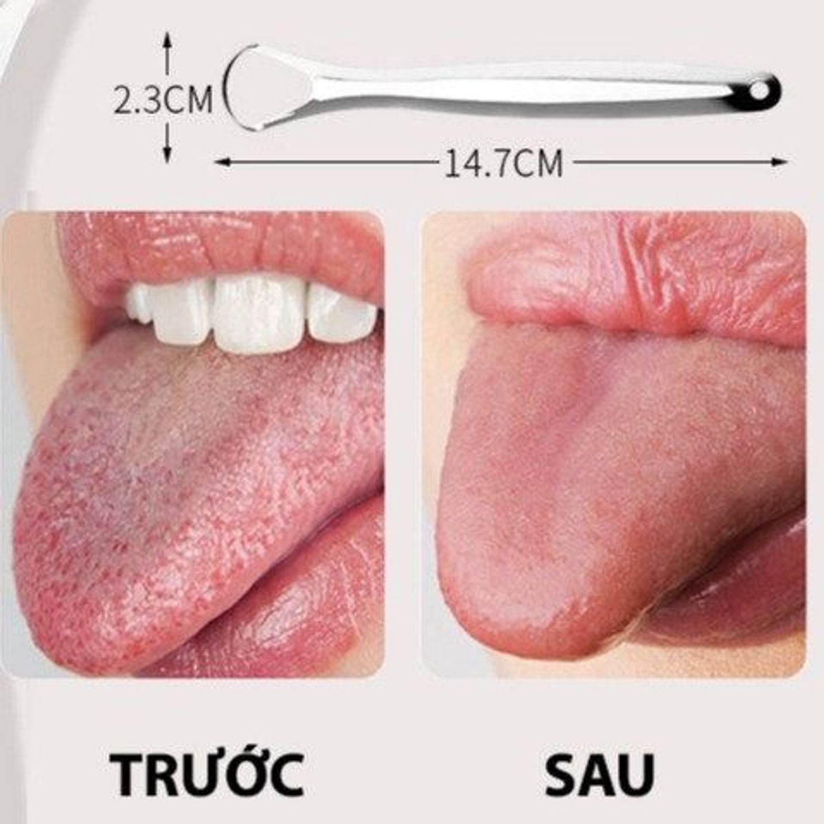 DỤNG CỤ CẠO LƯỠI, VỆ SINH LƯỠI DỤNG CỤ CẠO LƯỠI, VỆ SINH LƯỠI