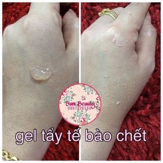 Gel tẩy tế bào chết body