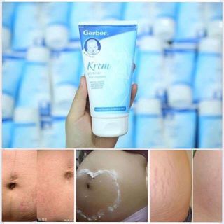 Trị rạn da gerber krem - 180k