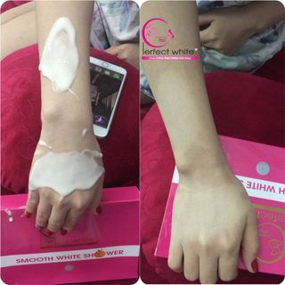 Tắm trắng body