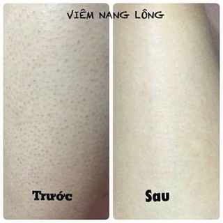 Muối tắm linh nhâm