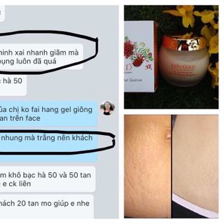 Mỹ phẩm apple kiss
