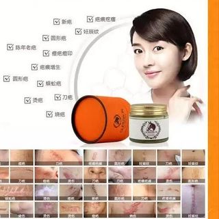 Kem ngựa guerisson chuẩn hàn quốc