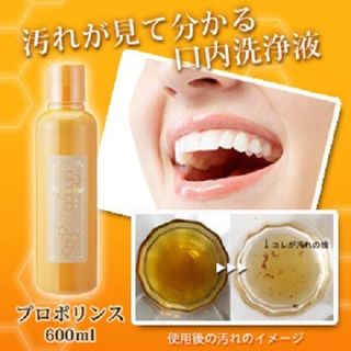 Nước súc miệng diệt khuẩn và làm sạch mảng bám propolinse