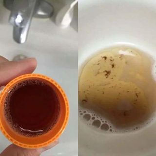 Nước súc miệng thần thánh propolinsex