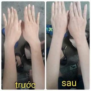 Tắm trắng nellyp