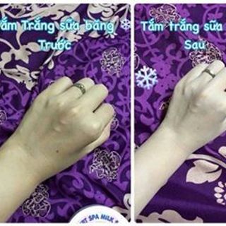 Tắm trắng sữa băng