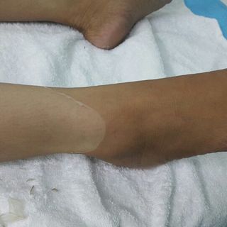 Thay da sinh học collagen