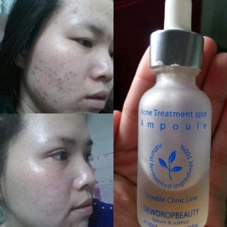 Serum dewdrop-dưỡng da căng mịn