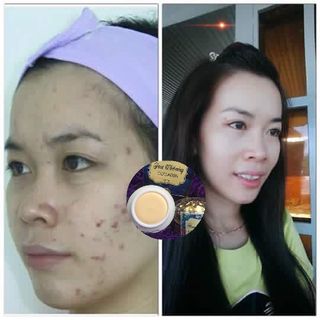 colagen tái tạo da