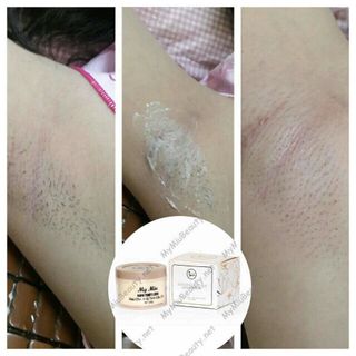 Kem triệt long my miu