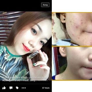 Serum teana nga