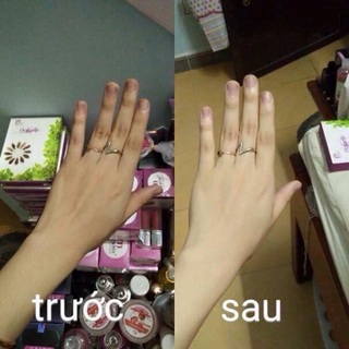 Tắm trắng thảo mộc mwhite