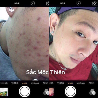 Sắc mộc thiên