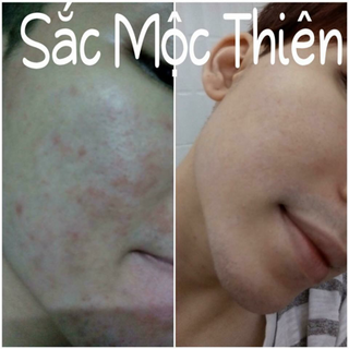 Sắc mộc thiên