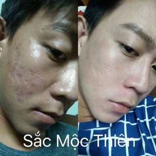 Sắc mộc thiên