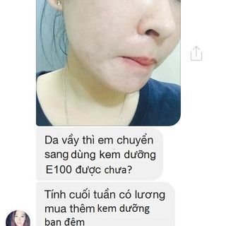 Kem trị mụn turmeric cream