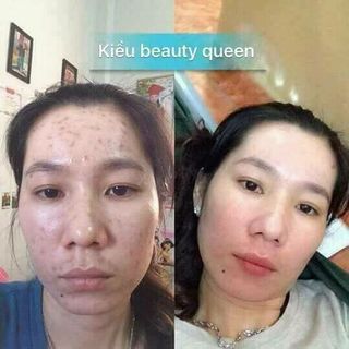 Serum thảo dược