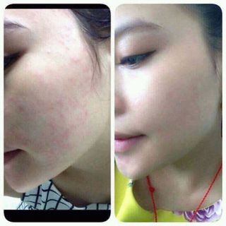 Serum thảo dược
