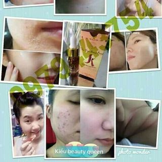 Serum thảo dược