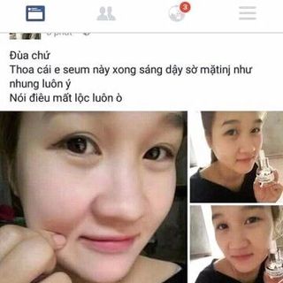 Serum cpllaren