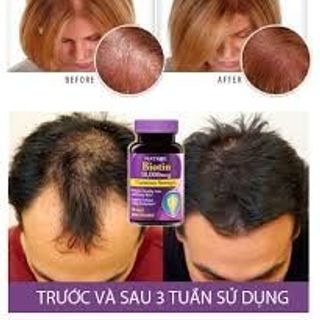 Biotin - dưỡng mọc tóc và móng mỹ