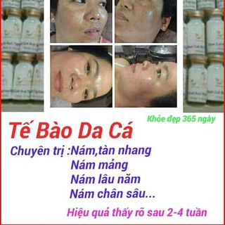 Tế bào gốc đặc trị nám