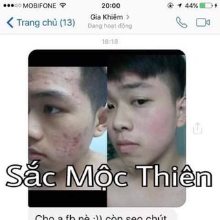 Thuốc tri mụn sắc mộc thiên
