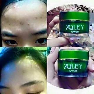 Combo trị mụn