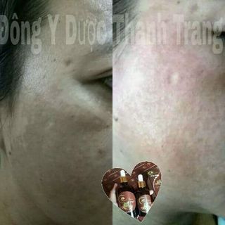 Đông y dược thanh trang