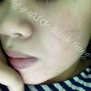 Đông y dược thanh trang