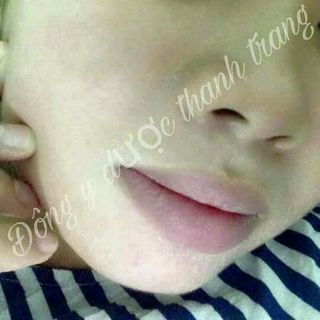 Đông y dược thanh trang