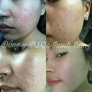 Đông y dược thanh trang