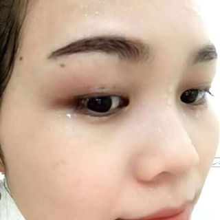 Tam trang trị mun tàn nhang giá sỉ