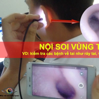 Camera nội soi android 7mm