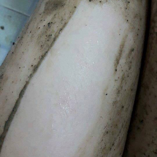 Tắm trắng thảo mộc