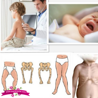 Ostelin vitamin d calcium kids chewable 50 - bổ sung canxi và vitamin d cho bé