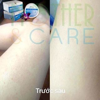 Muối tắm thảo dược trị viêm mother care