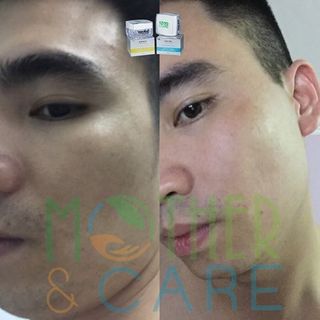 Kem mờ nám ban ngày mother care