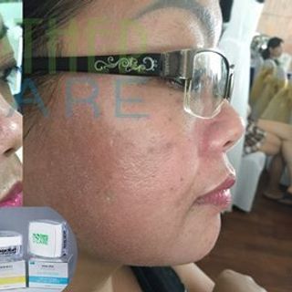 Kem mờ nám ban ngày mother care