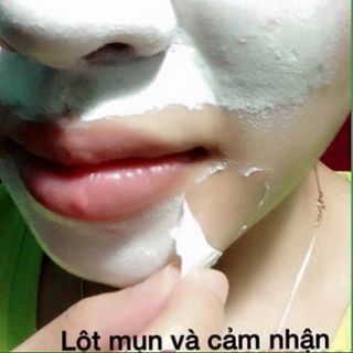 Gel lột mụn mother care