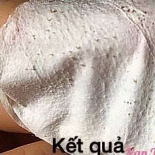 Gel lột mụn mother care