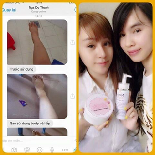Kem kích trắng da toàn thân baby white