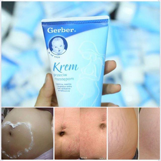 Kem trị rạn da gerber krem nga trước hoặc dau khi sinh