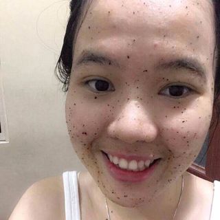 Tẩy da chết lrocre